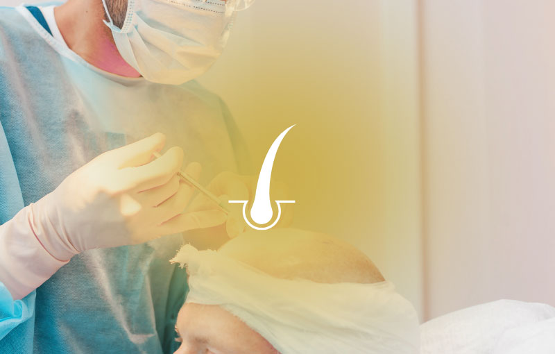 Clinica de injerto capilar